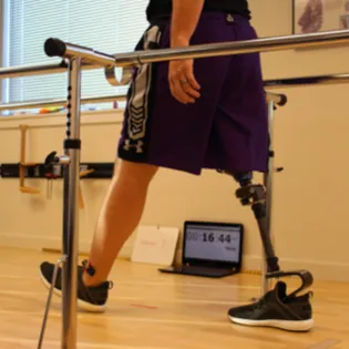 Prosthetic Knee Image